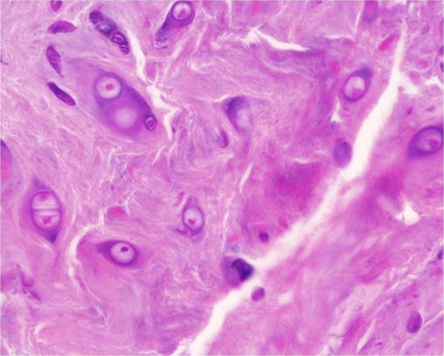 <p>-collagen fibers</p><p>-chondrocytes</p>