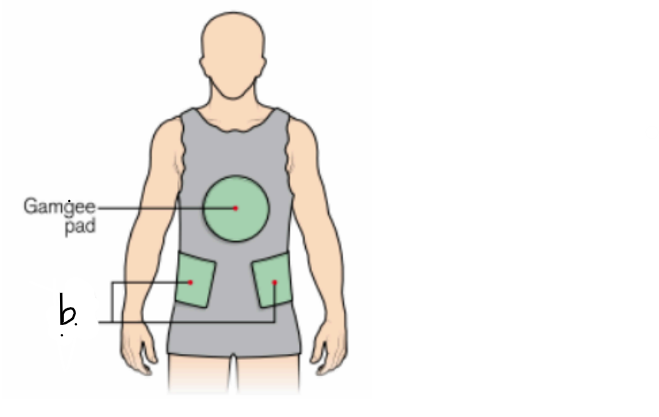 <ul><li><p>what type of cast is this? (indicate the view) </p></li><li><p>label the letter b.</p></li></ul><p></p>