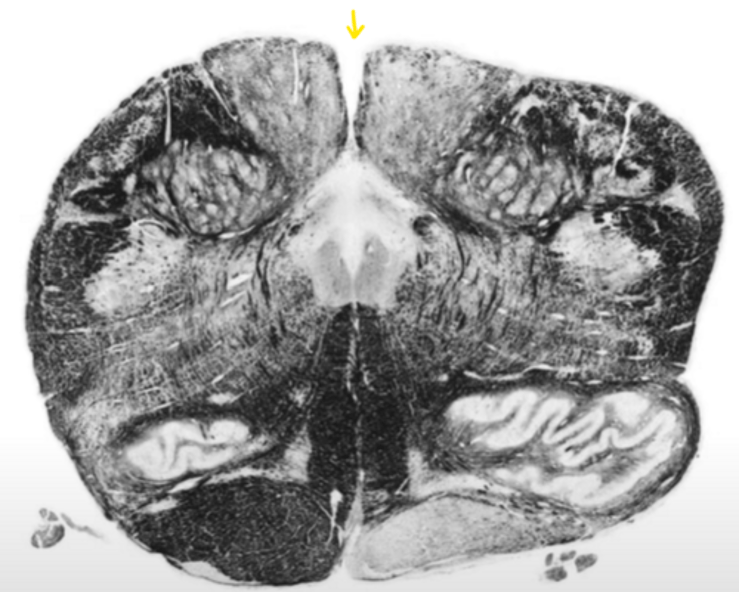 <p>ID the structure</p>