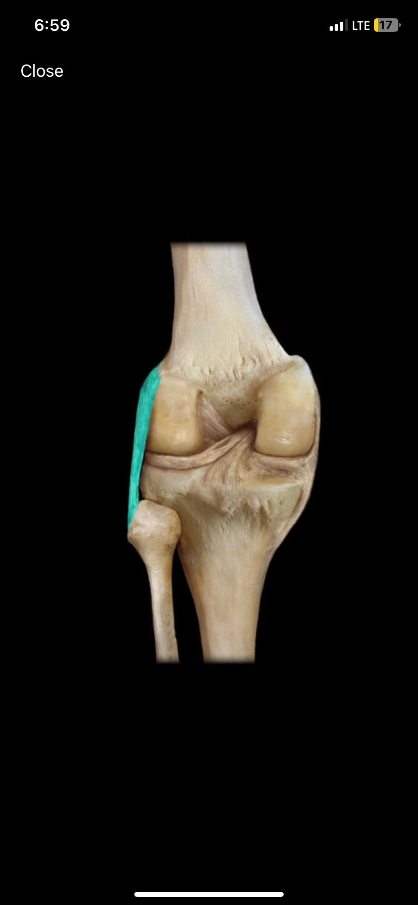 <p>A ligament located on the lateral side of the knee joint.</p>