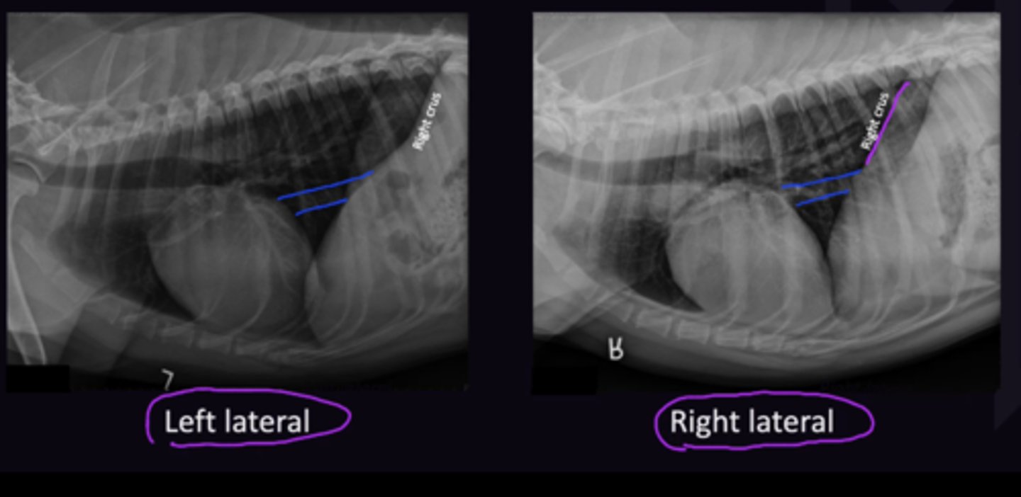 <p>Enters diaphragm on Right side (Goes through Right Crus).</p>