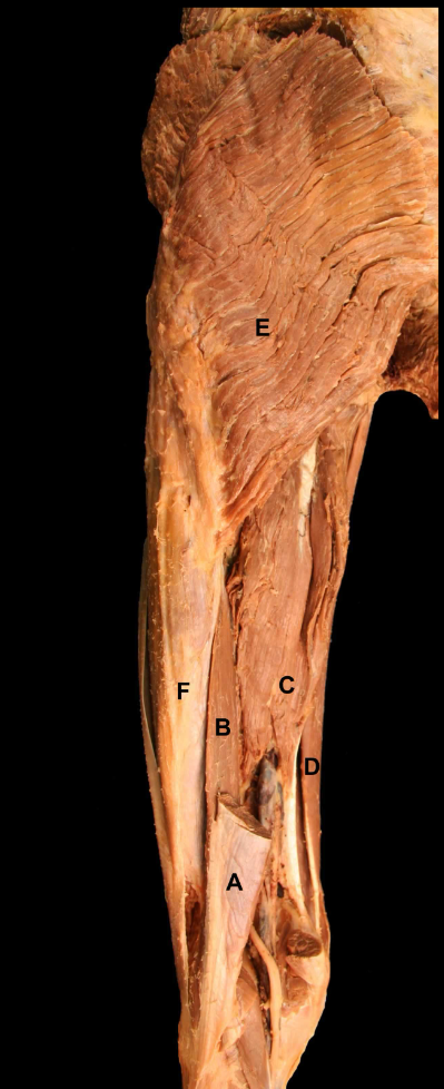 <p>E</p>