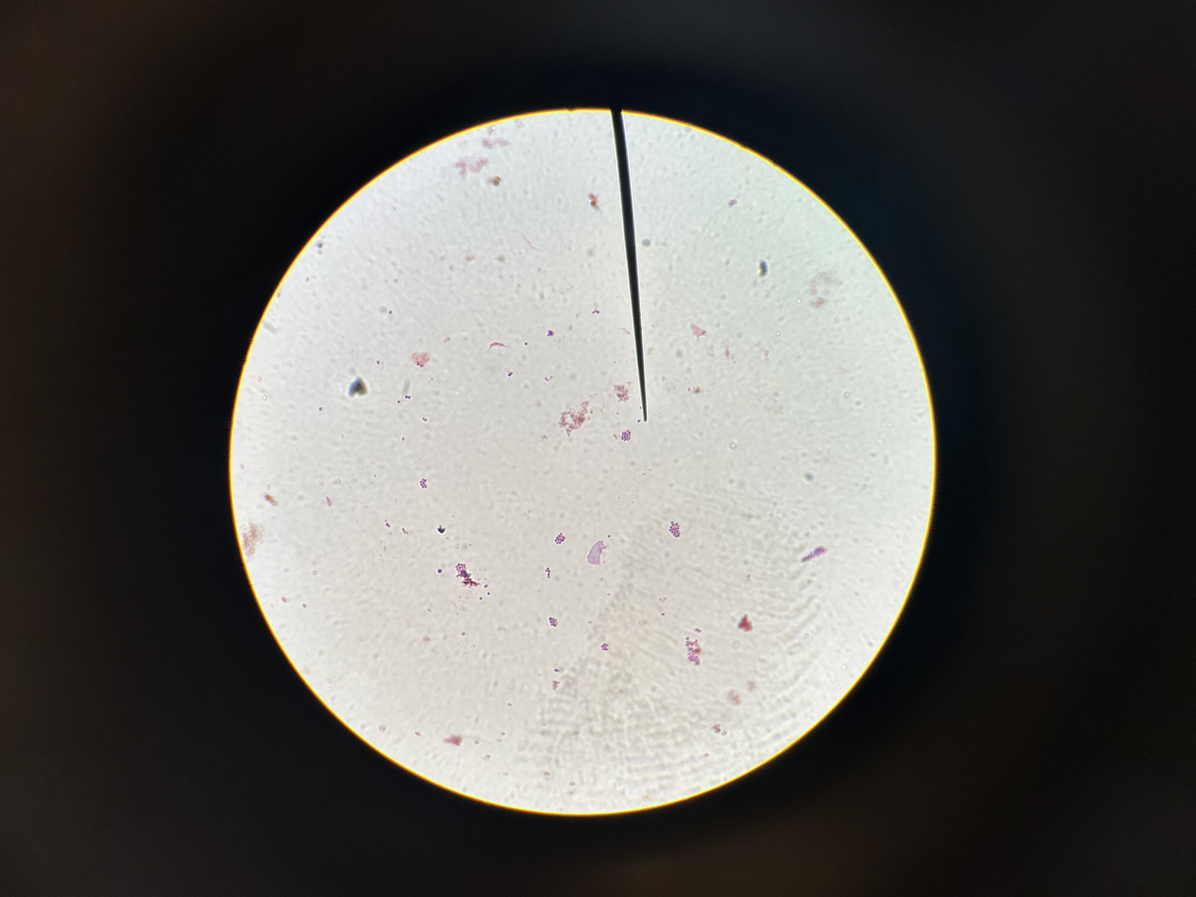<p>S. epi</p>