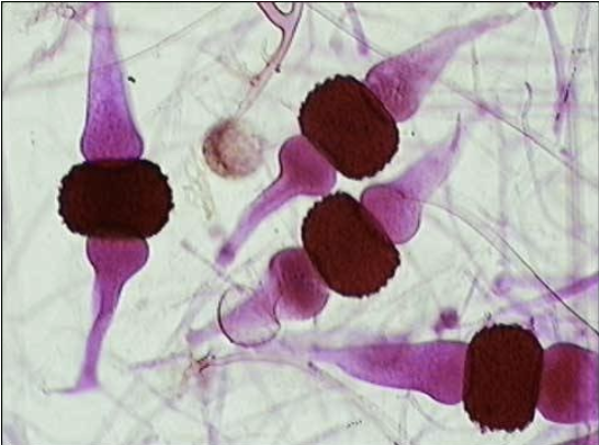 <p>What reproductive stage is this bread mold in?</p>