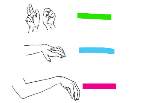 <p>Lähmungsfolgen</p><ul><li><p>wenn motorische Fasern ausfallen</p></li></ul><p></p>