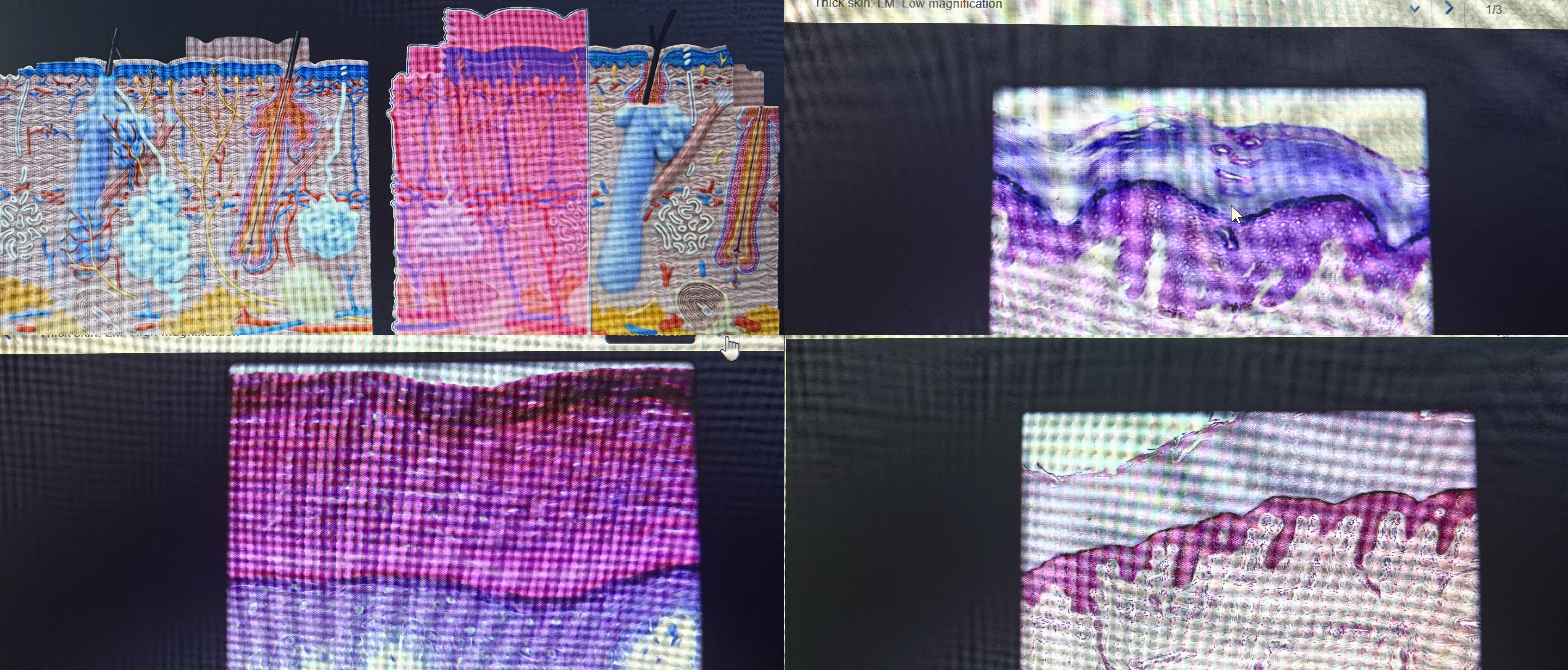 <p>Location- palm anterior surface of fingers </p><p>All 5 layers if epidermis are found in the thick skin. Contains sweat glands but no hair follicles.</p>