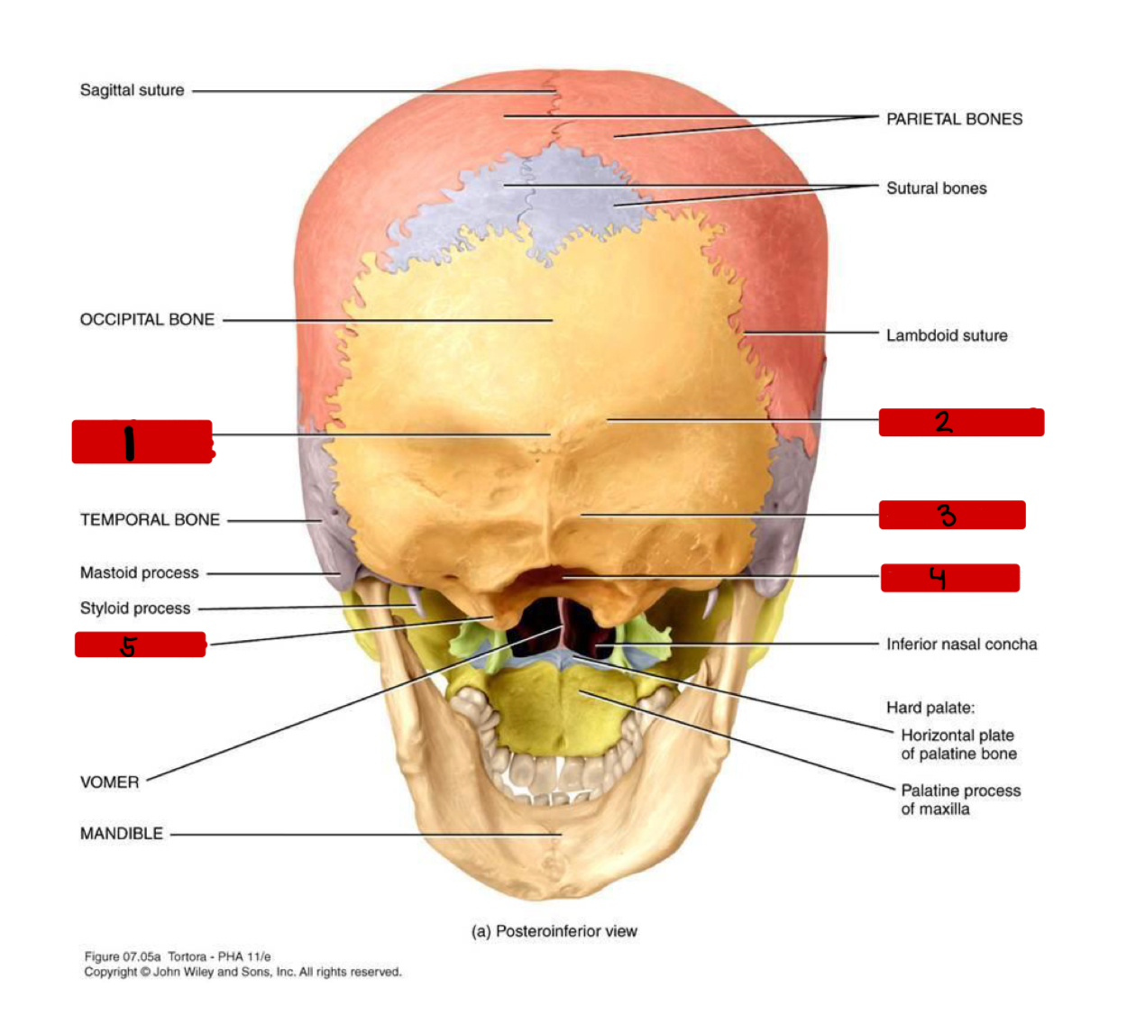 <p>1 on diagram</p>