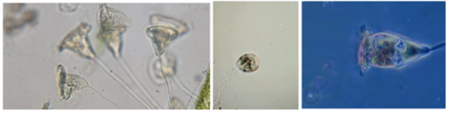 <p>What is the GENUS of this organism?</p>