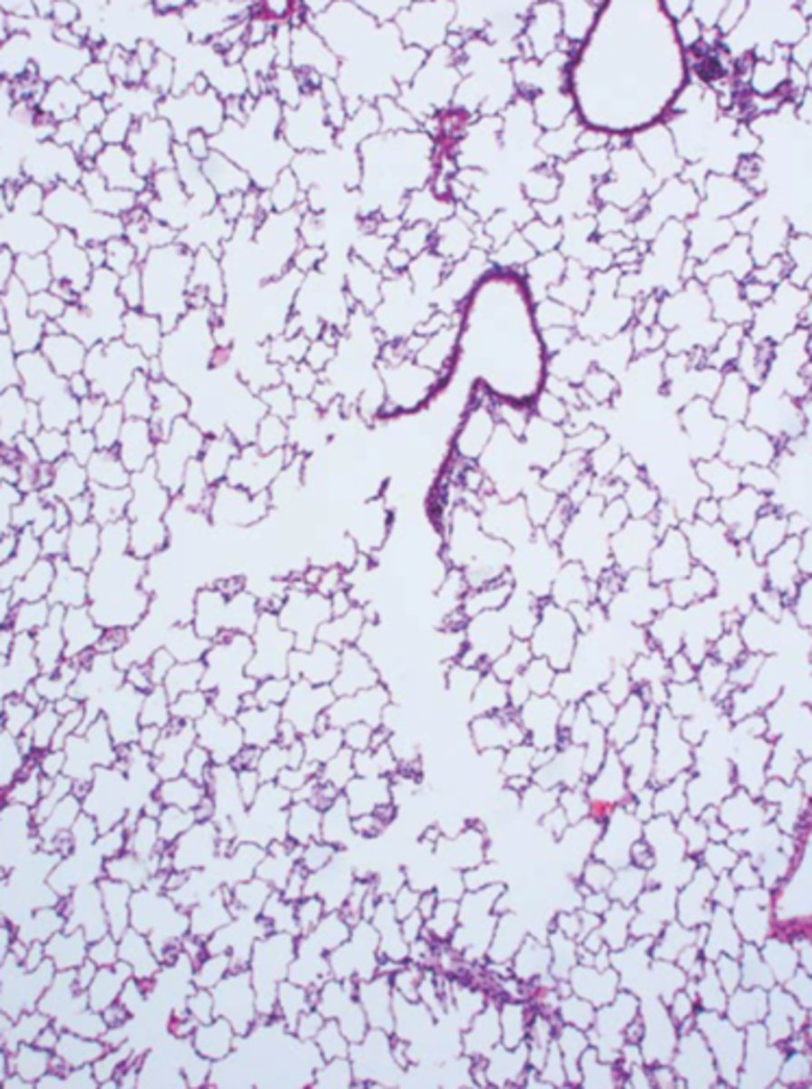<p>Name the organ</p>