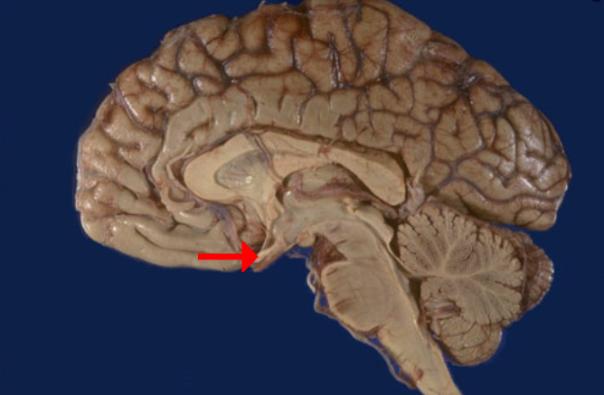 <p>Label this brain structure</p>