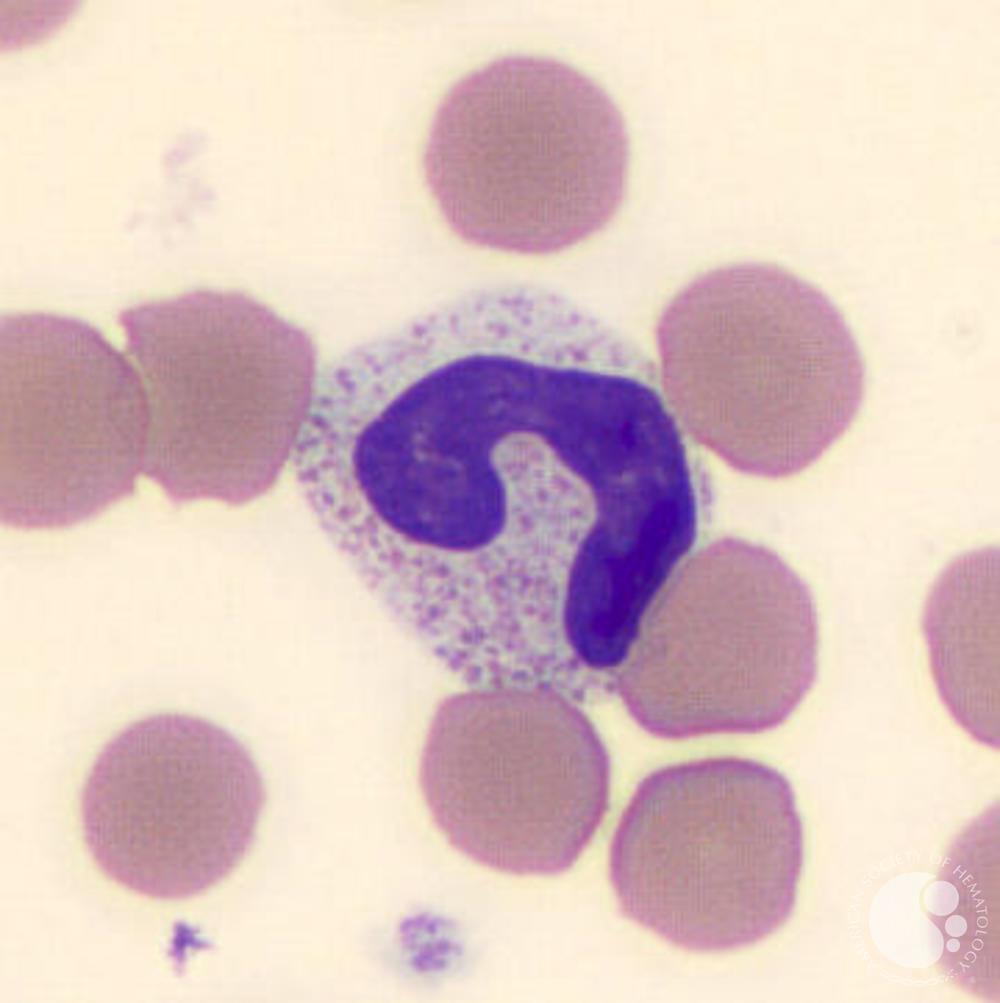 <ul><li><p>size: 9-15 um</p></li><li><p>nucleus is C or S shaped</p></li><li><p>cytoplasm is brown-pink with fine granules</p></li><li><p>CD45, CD13, CD15, CD11</p></li></ul><p></p>