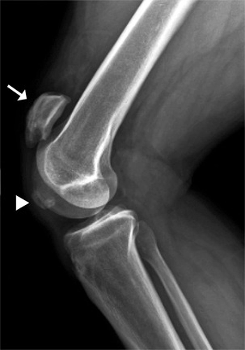 <p>type of joint indicated in image</p>