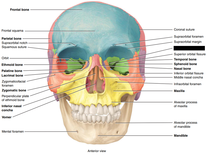 <p>State and identify which part of the cranial bone is being censored.</p>