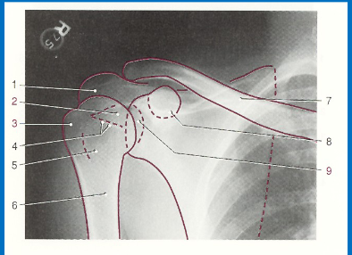 <p>without labeling, this is the anatomy of what kind of x-ray? (projection and body part) </p>