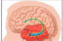 <p>in the medial temporal lobe of cerebral cortex</p>