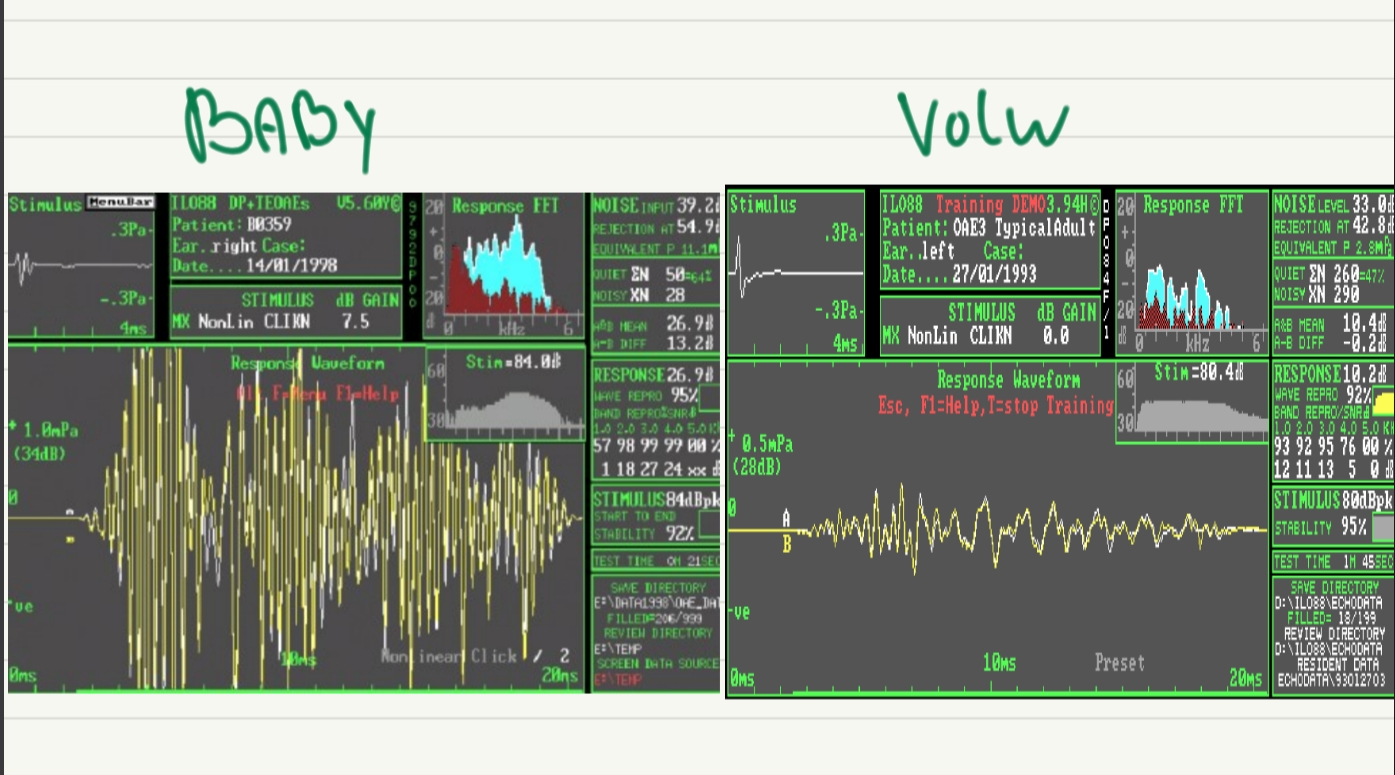 <p>baby = Een kleiner volume genereert een grotere geluidsdruk in de uitwendige gehoorgang en een hogere ear canal resonantiefrequentie.</p>