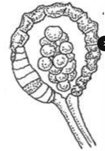 <p>Leptosporangiate sporangium </p>