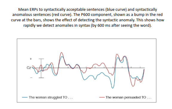 <p><strong>P600 Component</strong> </p>