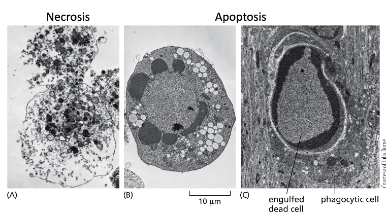<p>Cytoskeleton collapses</p><p>Nuclear envelope disassembles</p><p>Nuclear DNA breaks up into fragments</p><p>Plasma membrane alters to attract phagocytic cells (macrophages) to engulf and remove the apoptotic cell before it leaks out and recycle the organic components</p><p>of the apoptotic cell</p>
