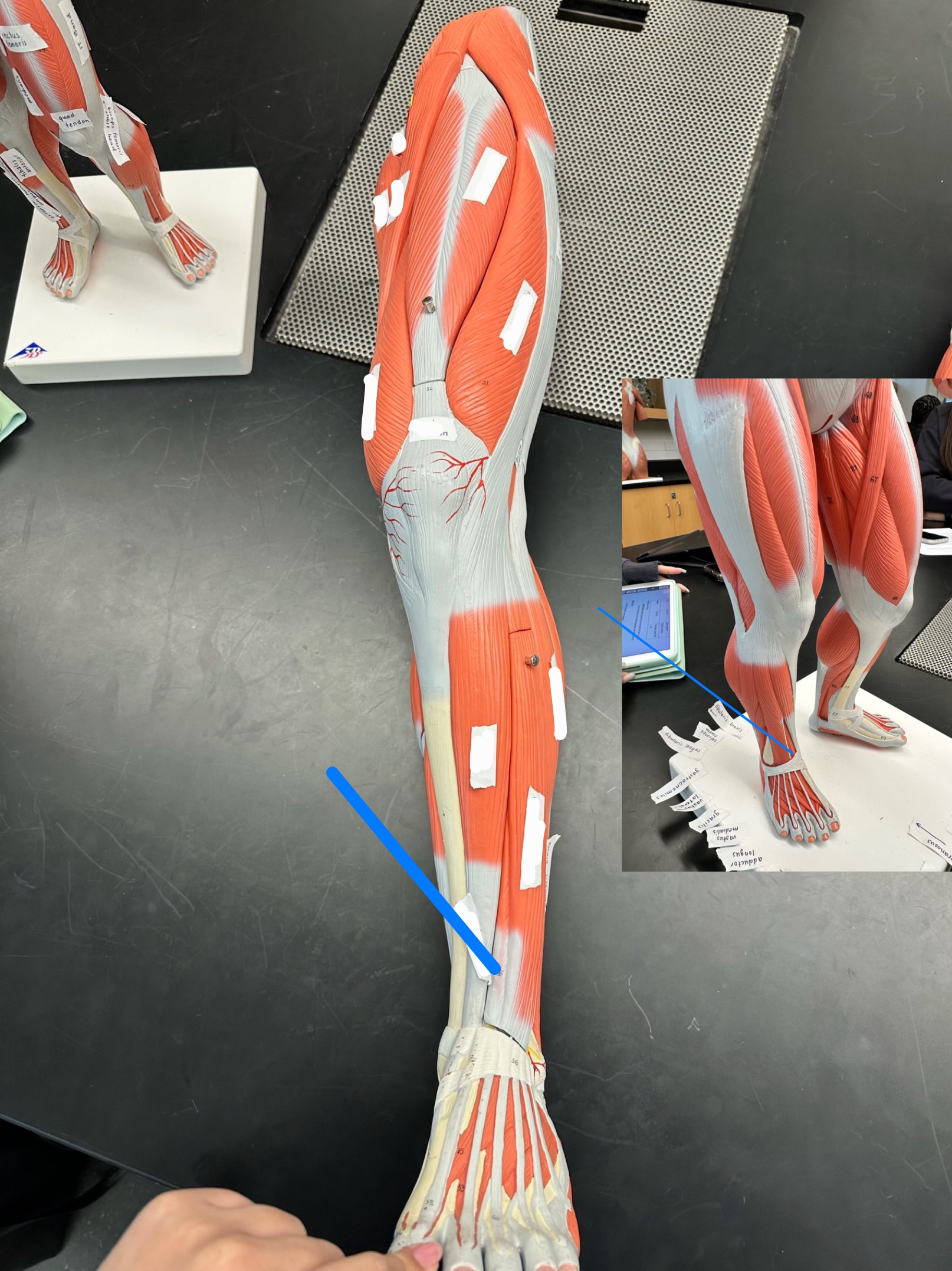 <p>ID muscle</p>