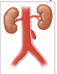 <p>What aneurysm shape is the following</p><ul><li><p>hematoma that forms as the result of a leaking hole in an artery</p></li></ul><p></p>