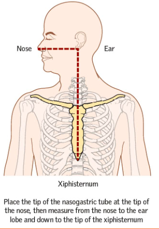 <p>N: nose</p><p>E: ear</p><p>X: typhoid process </p>