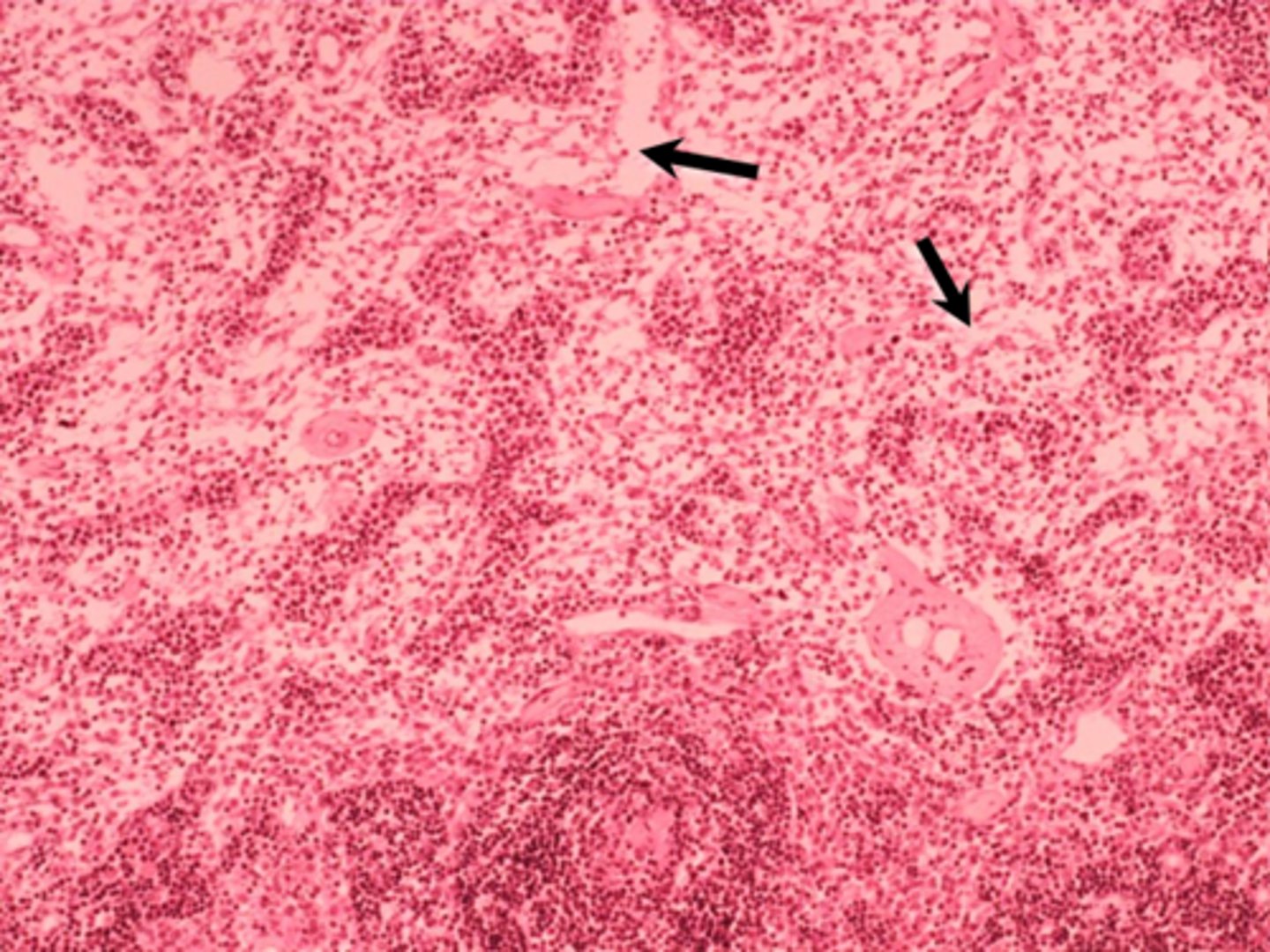 <p>black arrows</p><p>medullary sinuses</p>
