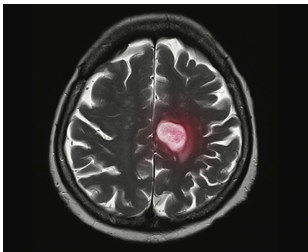 uses magnetic and radio fields to take two and three-dimensional images of the brain and record \n its activity levels.