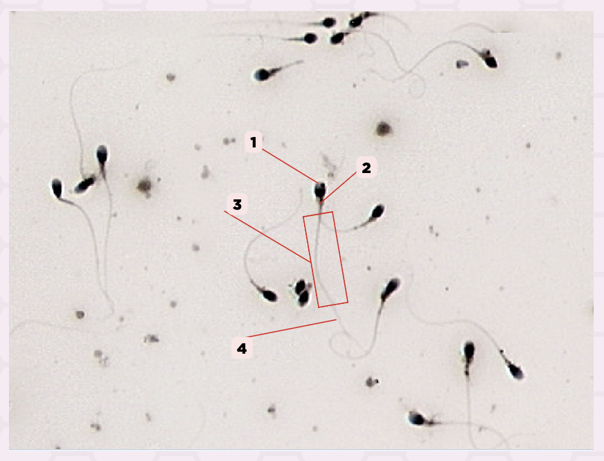 <p>Identify the structure labeled as 1.</p>