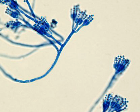 <p>what is this? what genus + fungi type is it?</p>