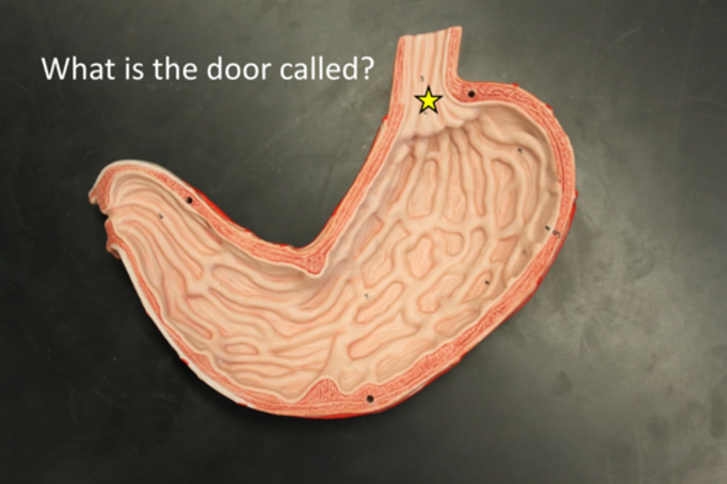 <p>separates the esophagus from the stomach (aka: gastroesophageal sphincter OR lower esophageal sphincter)</p>