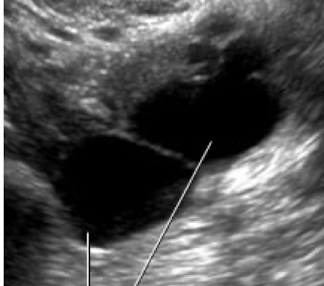 <p>What is this and what type of scan </p>