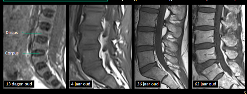 <p>kenmerken T1 venster </p>