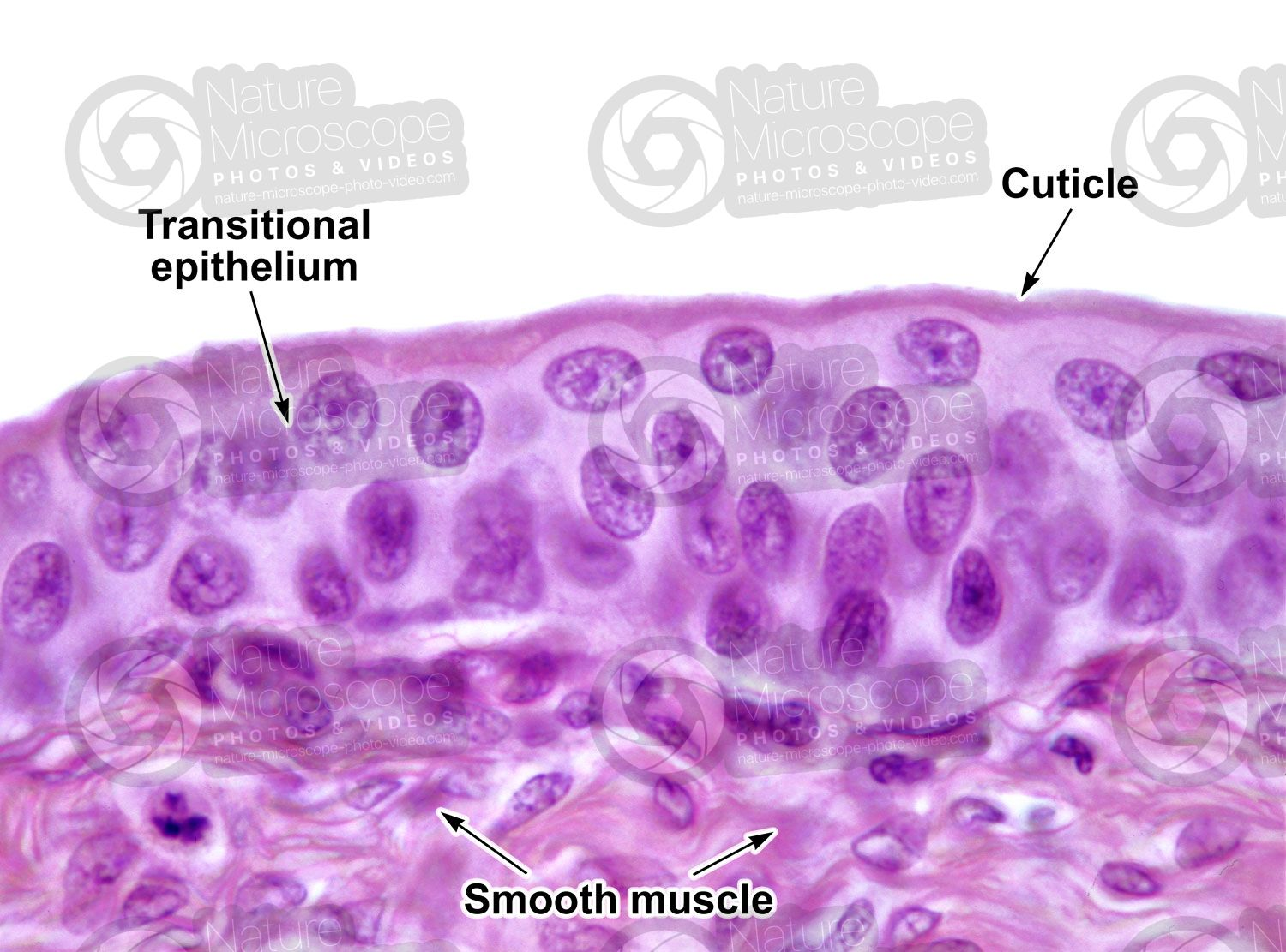 <p>convoluted and cuboidal apical cells with convex, umbrella shaped, apical surfaces</p>