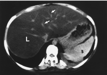 <p>Name the pathology</p>