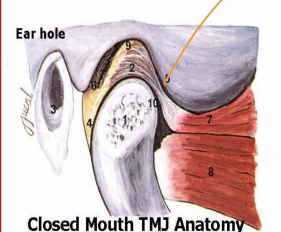 <p>articular disc</p>