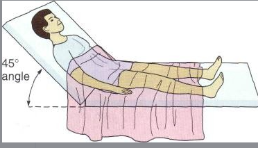 <p><span style="background-color: transparent;"><span>Fowler’s position</span></span></p>