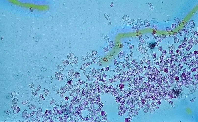 <p><span data-name="microscope" data-type="emoji">🔬</span><span data-name="petri_dish" data-type="emoji">🧫</span><strong><span> </span>Na podstawie zdjęcia preparatu:</strong></p><p></p><ul><li><p><span>📖 </span>rozpoznaj gatunek pasożyta;</p></li></ul><p></p><ul><li><p><span>♻ </span>rozpoznaj wszystkie formy rozwojowe;</p></li></ul><p></p><ul><li><p><span>🦠 </span>wskaż organelle i cechy charakterystyczne dla danego gatunku;</p></li></ul><p></p><ul><li><p><span>😷 </span>nazwij chorobę, którą pasożyt wywołuje.</p></li></ul><p></p>