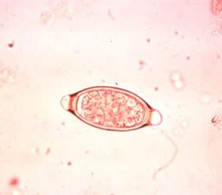 <p>pigs cecum and colon anemia anorexia whipworm of pigs</p>