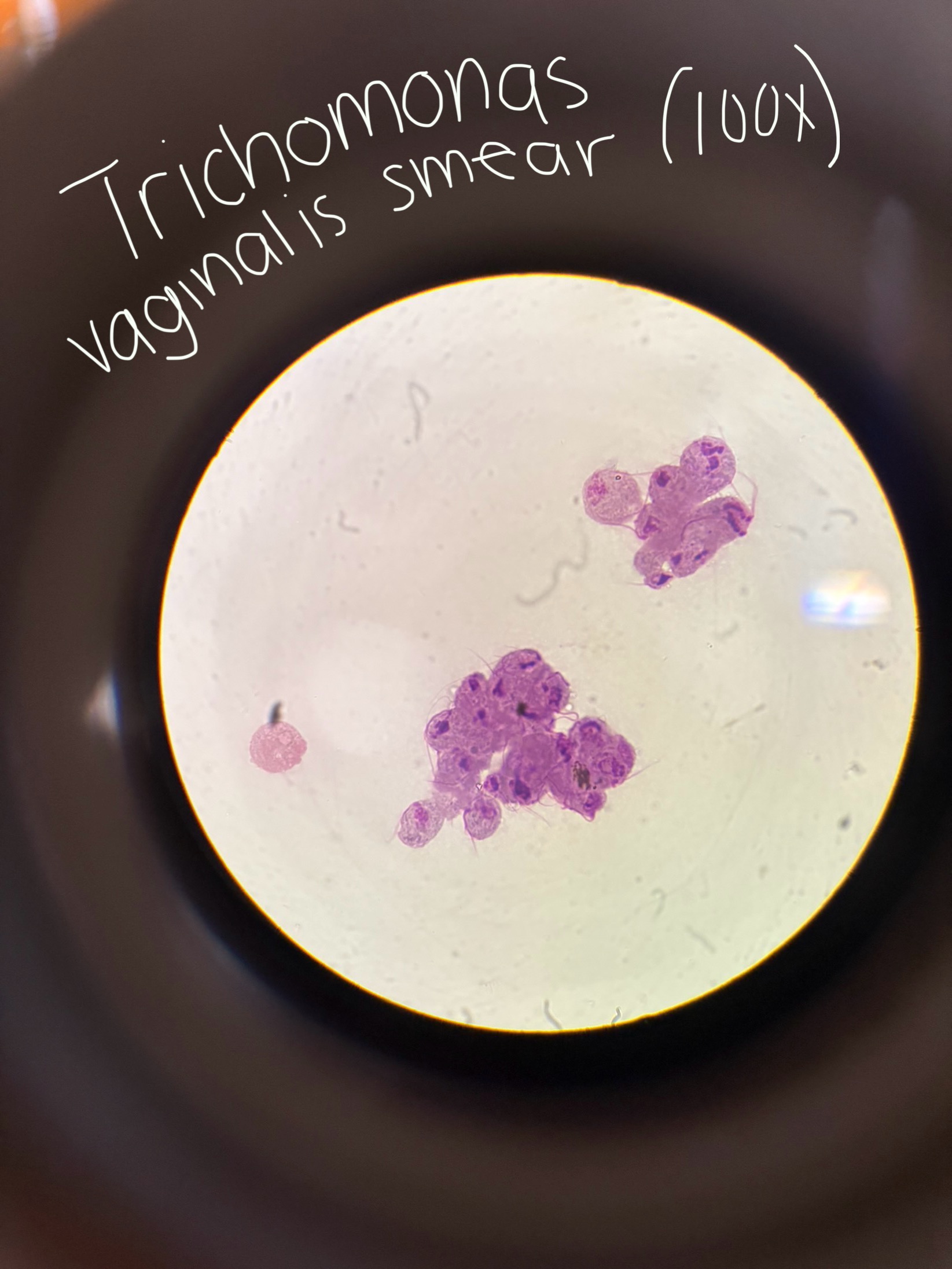 <p>Trichomonas vaginalis</p>