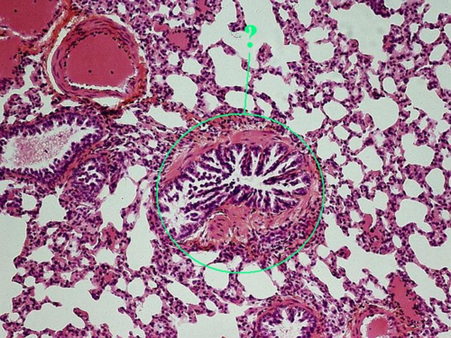 <p>Identify the indicated structure.</p>