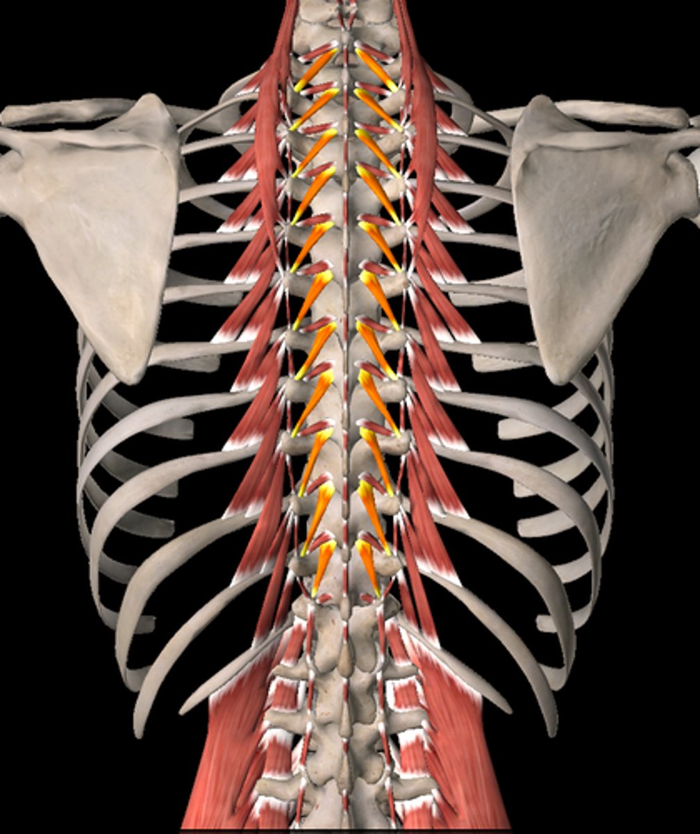 <p>Welke spier is dit (oranje)?</p>