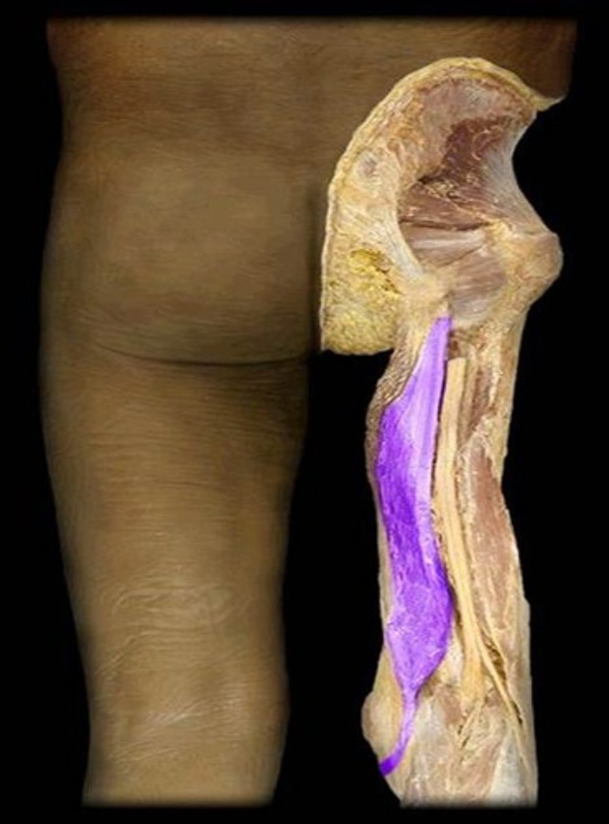 <p>What is the name of this muscle, highlighted in purple?</p>