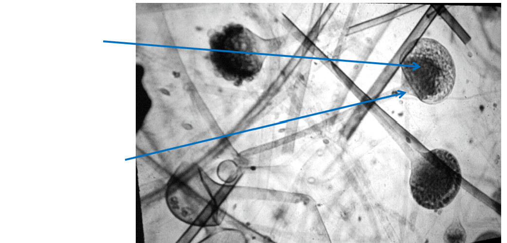 <p>Figure 3 - zygomycota</p>