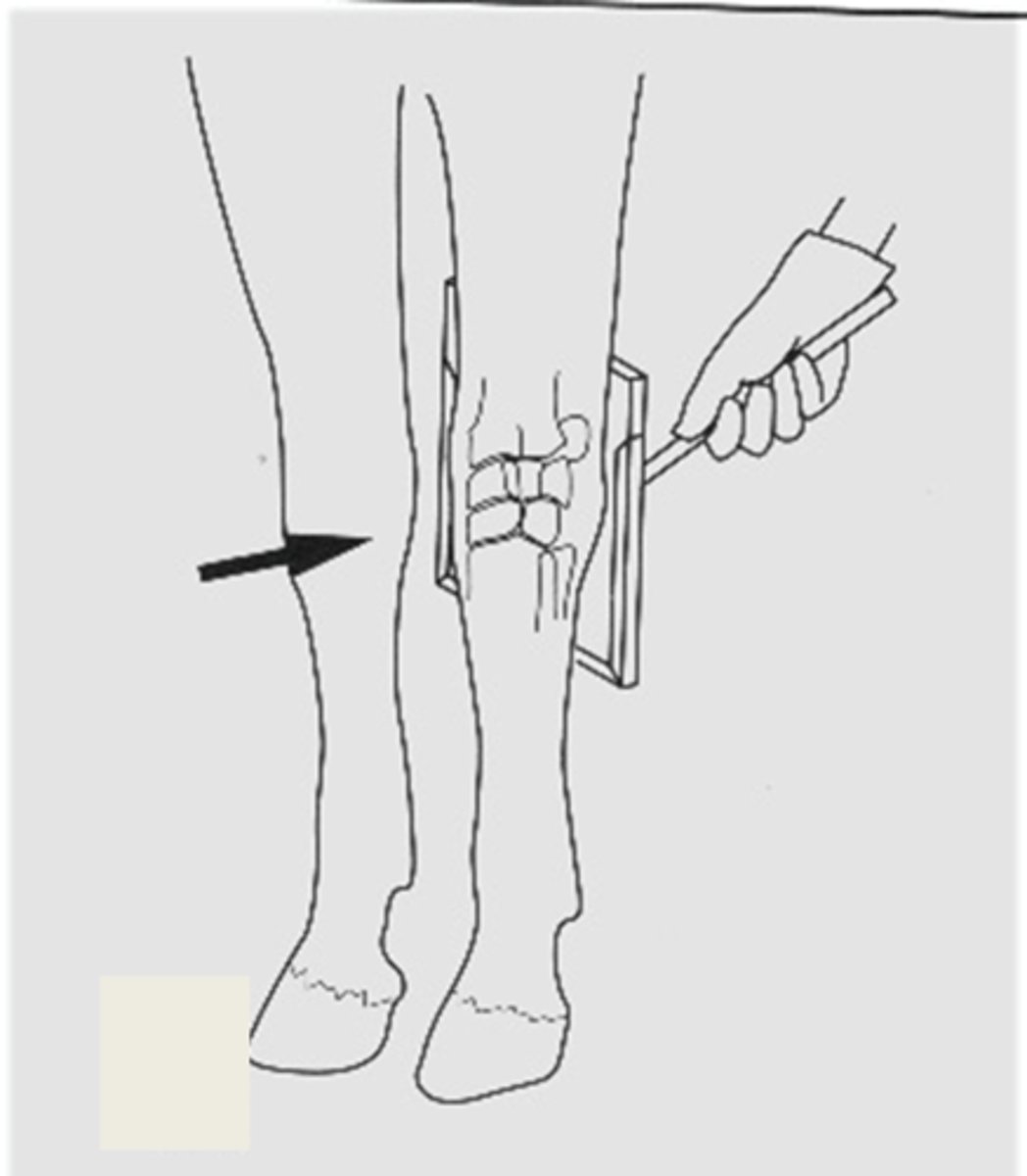 <p>What view is being taken?</p>