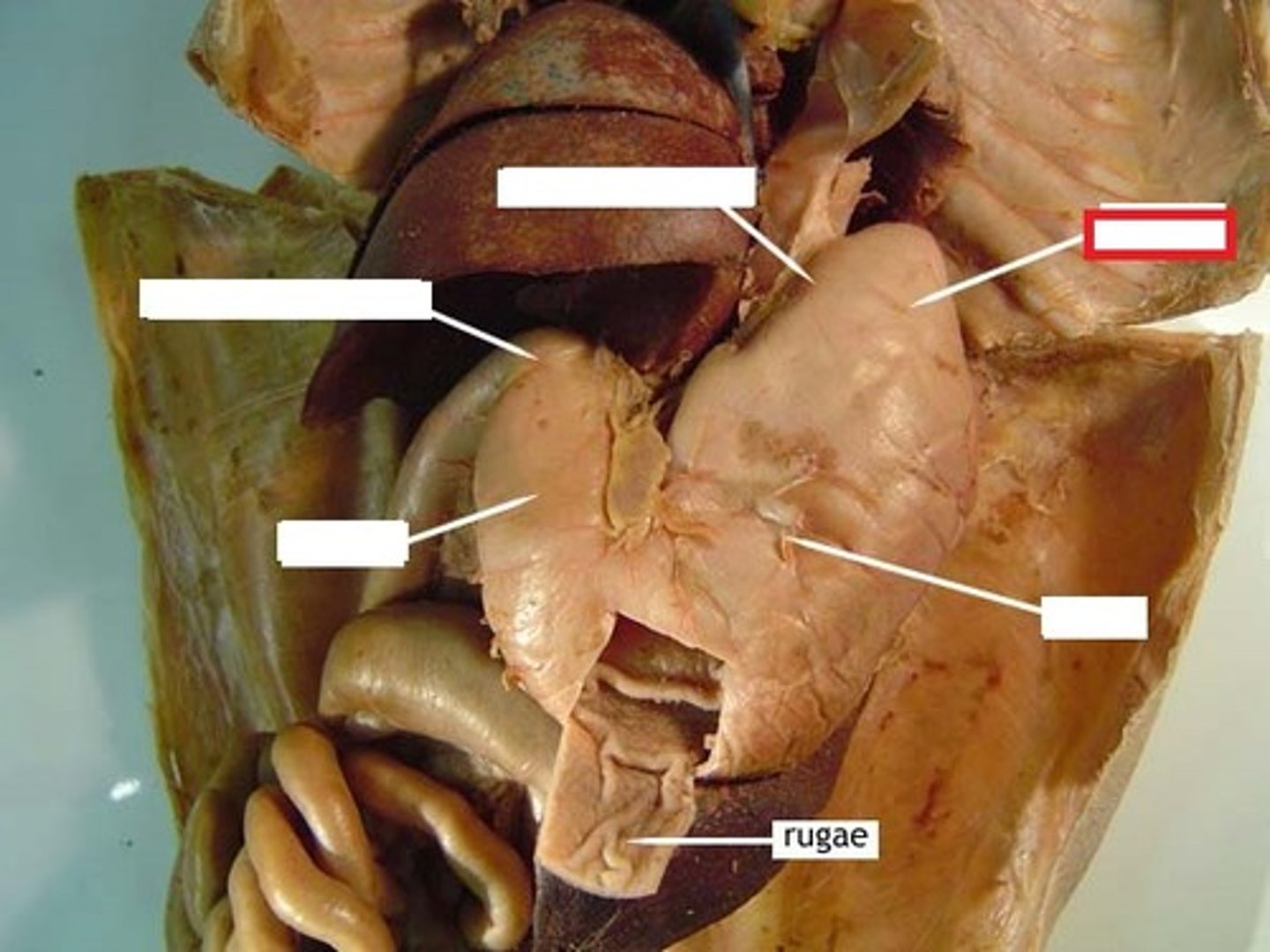 <p>name this part of the organ</p>