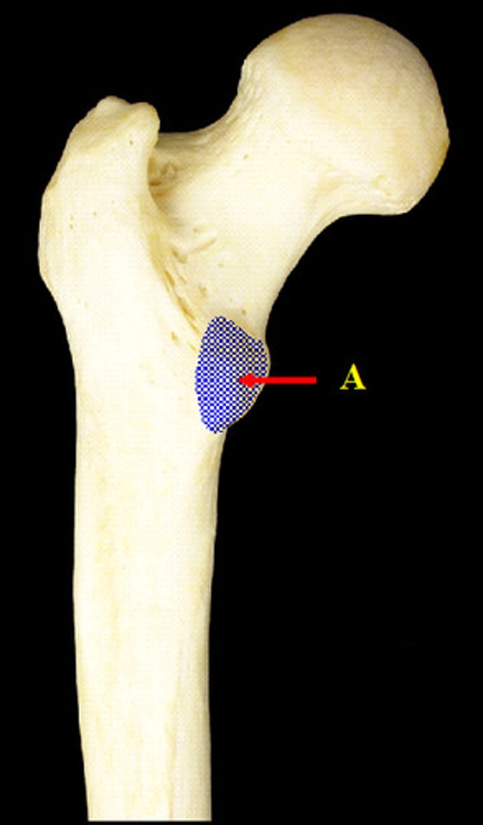 <p>medial</p>