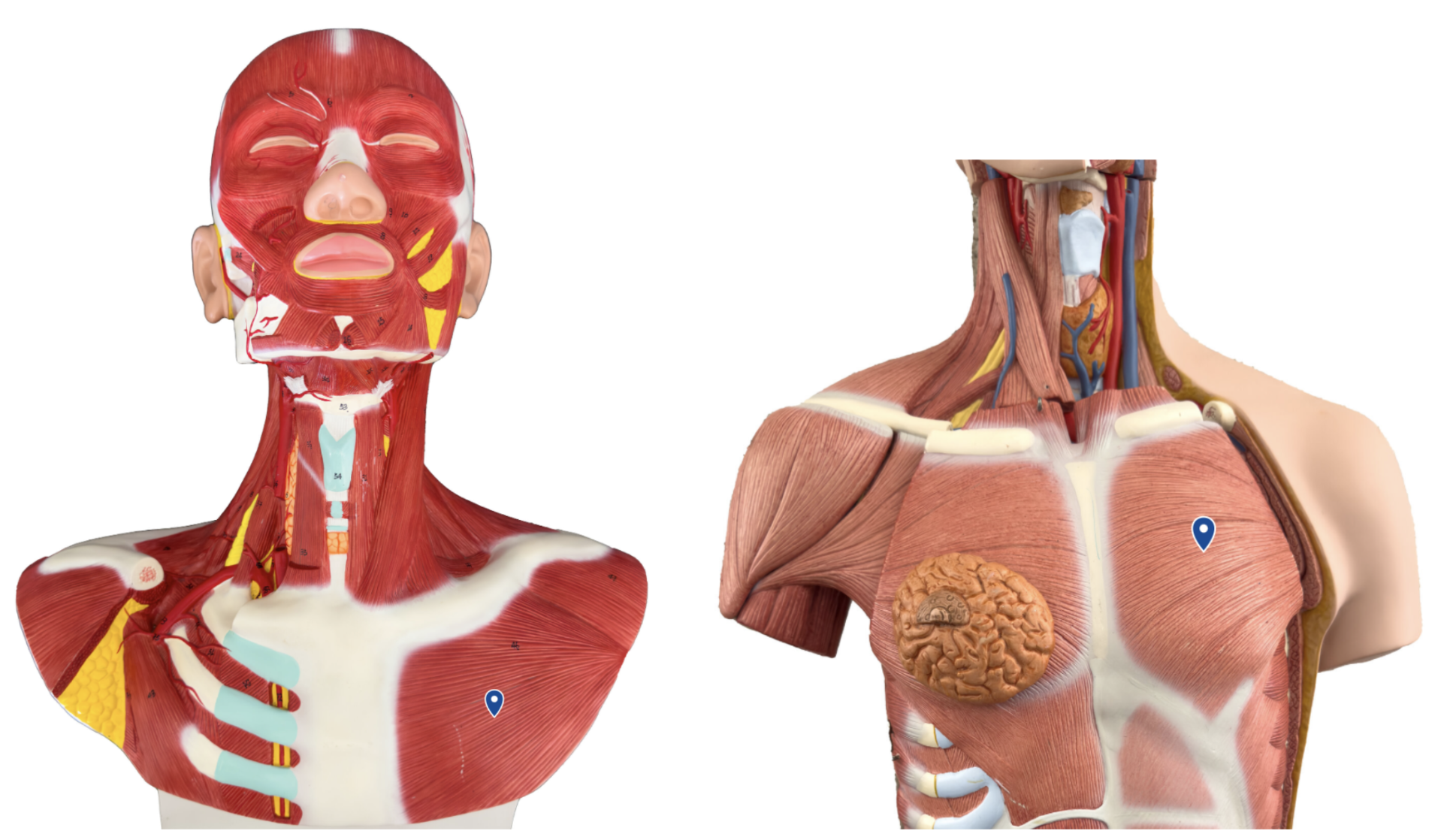 <p>What muscle is the arrow pointing to?</p>