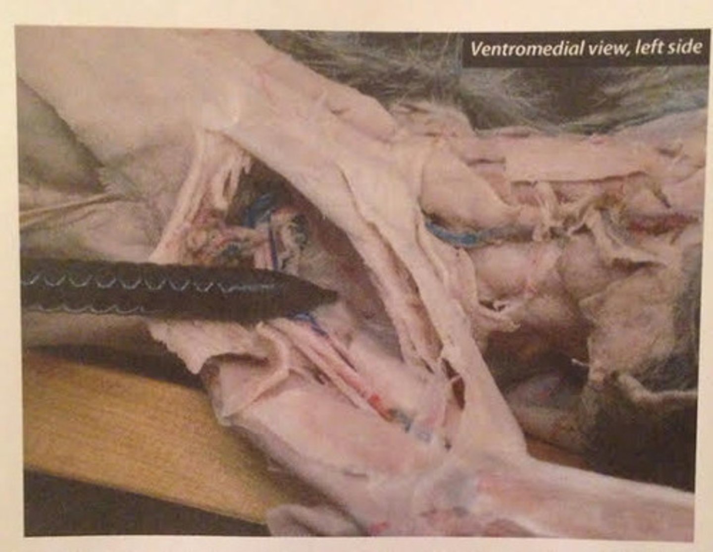 <p>What muscle is this?</p><p>Origin?</p><p>Insertion?</p><p>Action?</p><p>Nerve?</p>