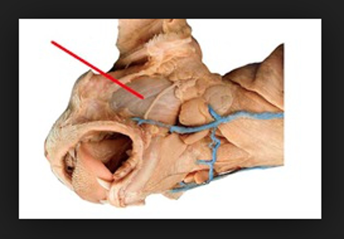 <p>name this muscle</p>